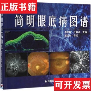 【正版现货】简明眼底病图谱李明翰、王静波编金盾出版社
