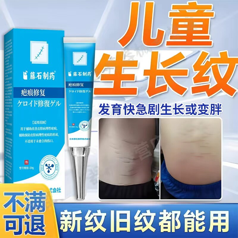 儿童学生青春期发育快急剧长高变胖腰部大腿内侧后背消除生长纹AH