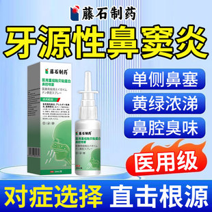 牙源性鼻窦炎上颌窦炎鼻塞浓涕鼻腔臭味头面部疼痛排脓喷雾剂AH