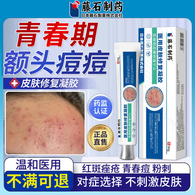 青少年痤疮粉刺修复凝胶