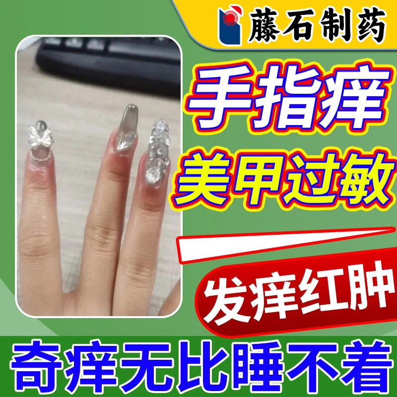 美甲甲油胶过敏手指头痒发痒红肿手指感染起水泡干裂脱皮湿疹AH
