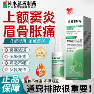 上额窦炎专用眉骨胀疼鼻塞浓涕头晕呼吸不畅过敏通气医用喷剂YK