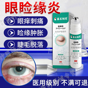 睑缘炎眼睑边缘眼皮水肿睫毛根发炎反复麦霰粒肿胀充血眼痒倒睫AH
