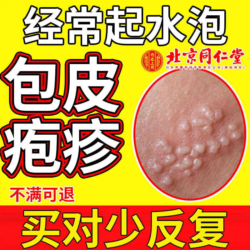 生殖器包皮疱疹包皮阴茎真菌感染水泡退热凝胶YK