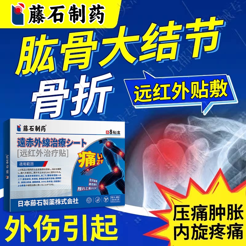 肱骨大结节骨折骨质疏松中老年压痛肿胀内旋疼痛可搭固定支具YK