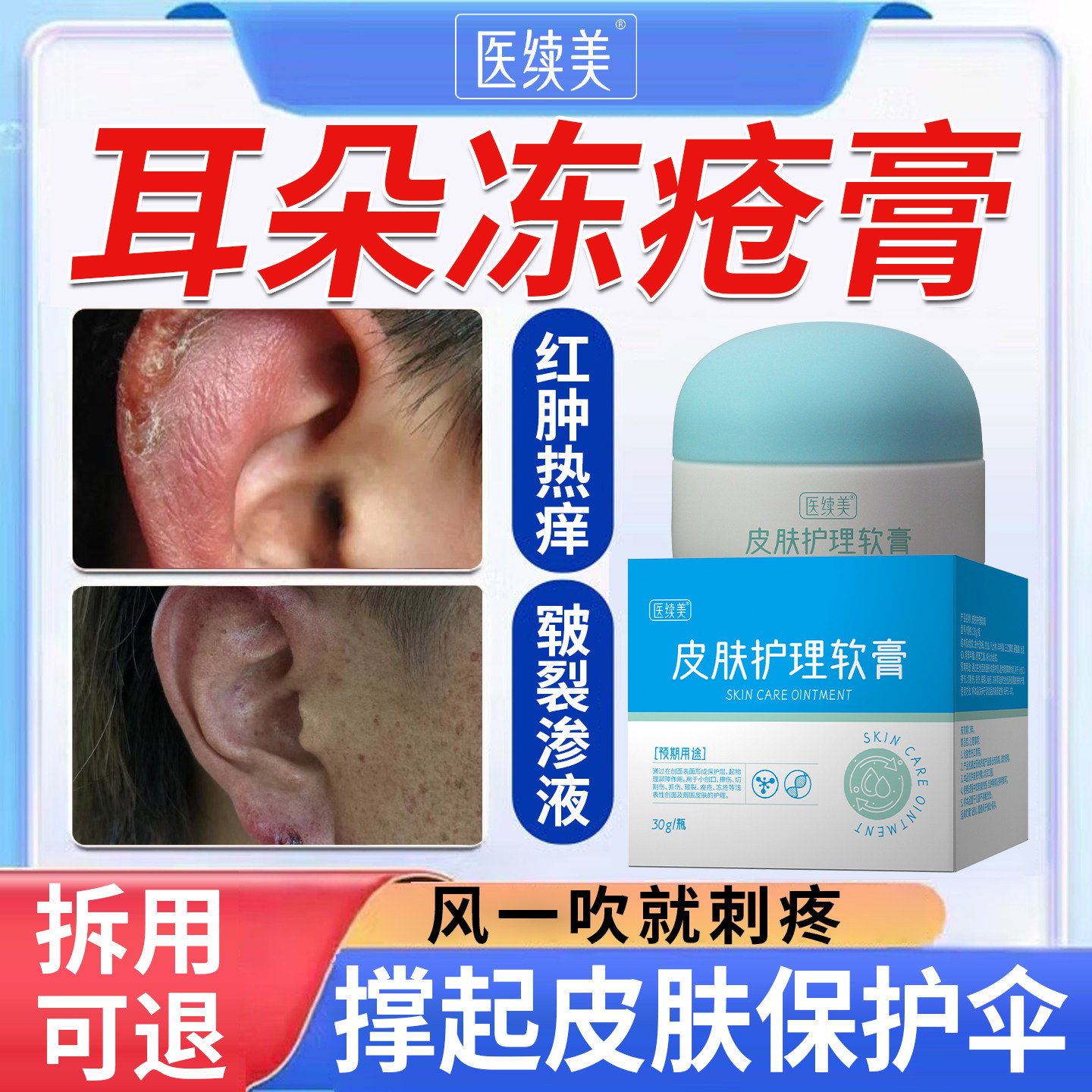 冬天耳朵冻疮红肿热痒皲裂渗液用专软膏医用止痒消肿药房同售YK