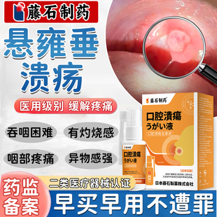 悬雍垂溃疡小舌头用专有灼烧感吞咽困难咽部疼痛异物感强烈YK