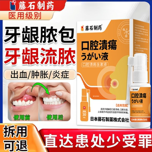 牙龈脓包流脓专用牙龈出血肿胀口腔炎症神经上火疼痛喷雾剂YK