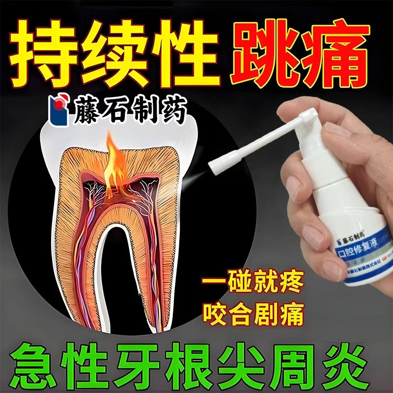 急性牙根尖周炎杀牙神经跳疼牙髓炎牙龈肿痛流脓喷雾剂AH