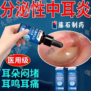 分泌性中耳炎咽鼓管堵塞病变耳朵闷胀流脓疼痛耳鸣屎多听力下降AH