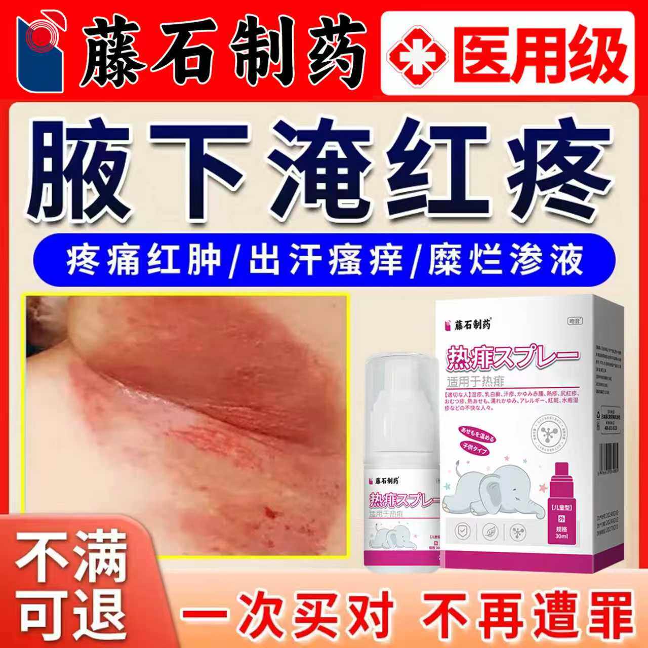 藤石制药腋下淹红胳肢窝淹出汗腋窝湿疹淹脖子红痒肿瘙痒疼痛膏AH
