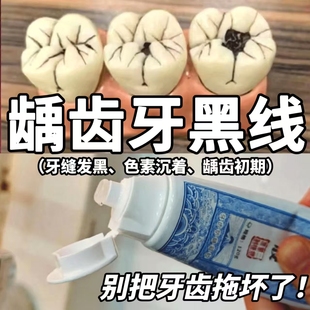 藤石制药龋齿牙黑线防蛀牙龋齿修复膏去黑线儿童3到6到12岁含氟AH