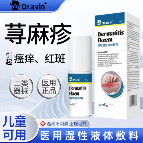 荨麻疹过敏瘙痒红斑可搭止痒膏寒冷性急慢性人工荨麻疹儿童喷剂WJ