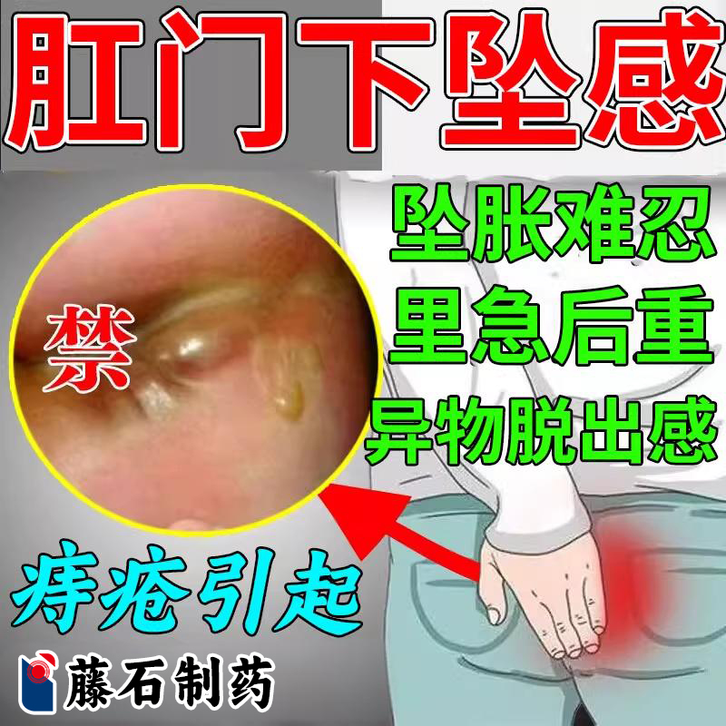 肛门下坠坠胀感内外混合痔疮肛窦炎直肠炎异物感直肠脱肛凝胶AH