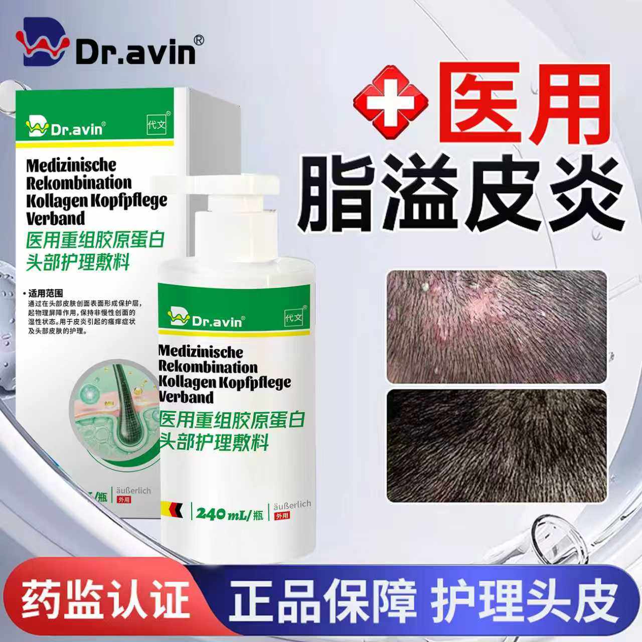 代文医用胶原蛋白头部护理敷料缓解脂溢皮炎头皮瘙痒干燥脱屑WT