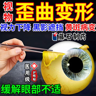眼底黄斑病变眼白发黄去黄浑浊模糊护眼贴可搭玻璃酸钠眼药水AH