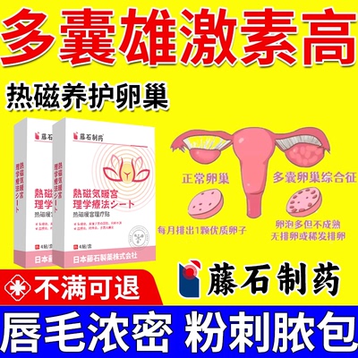 多囊卵巢综合征调理内分泌失调女性雄激素过高性脱发粉刺膏药贴AH