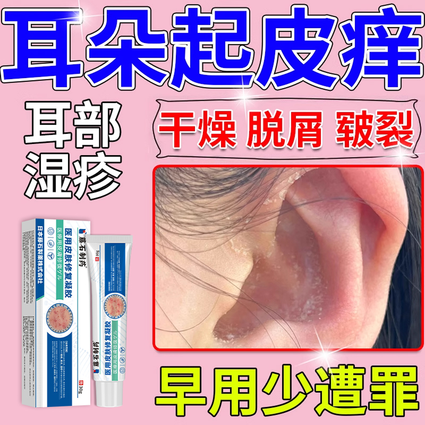 耳朵起皮干痒湿疹软膏外耳道真菌感染止痒耳后皲裂去皮屑脱皮AH