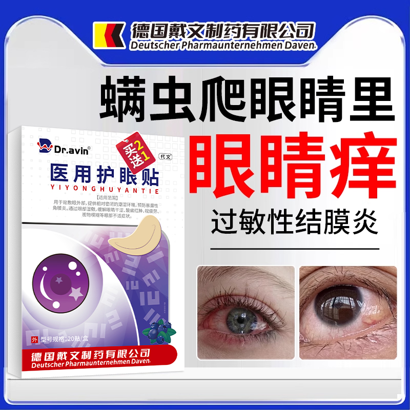 螨虫爬进眼睛里痒挠不停