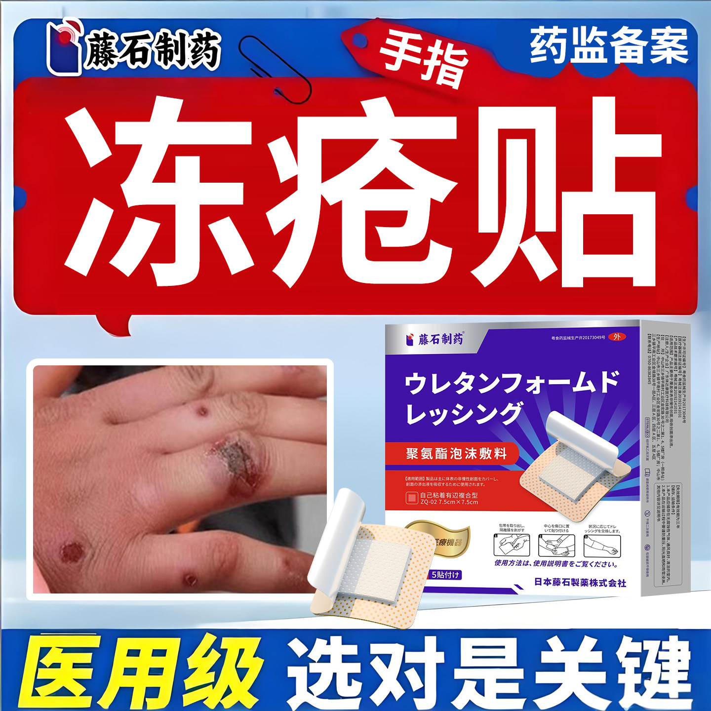 冬天手指冻疮贴红肿灼痛溃疡结痂干燥出血脱皮泛红泛紫专用贴YK