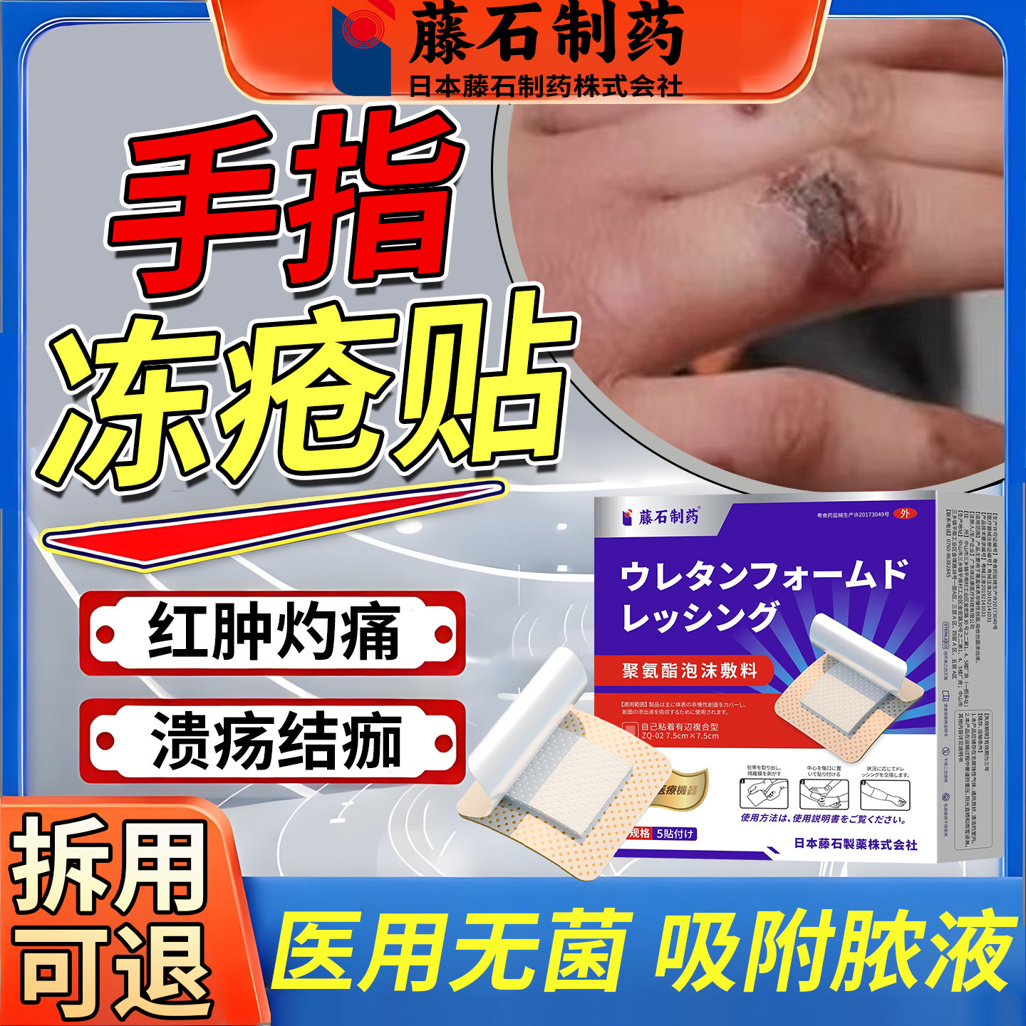 藤石制药手指冻疮贴红肿灼痛溃疡结痂干燥脱皮红肿泛红泛紫出血YK