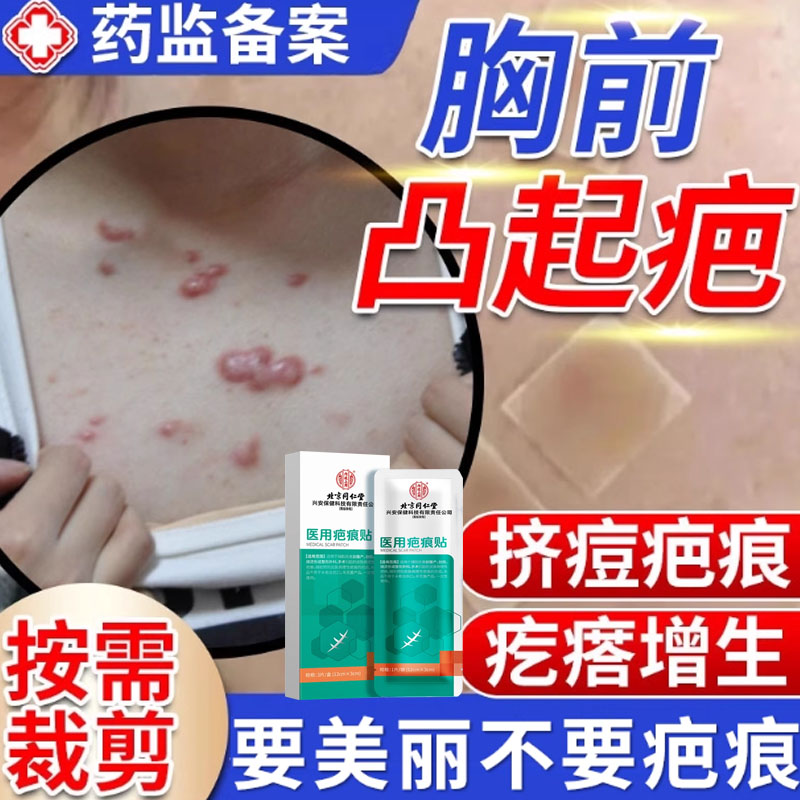 胸口疤痕增生凸起去除疙瘩疙瘩贴医用去疤膏去疤痕修复无痕祛疤DM