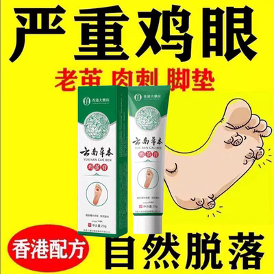 云南本草鸡眼贴鸡眼膏瘊子足部去脚底脚趾部跖疣灵老茧根肉刺