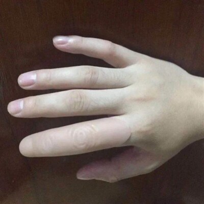 假手指套残疾人硅胶m仿真断指魔术防汗防滑固定乳胶食指套手指头