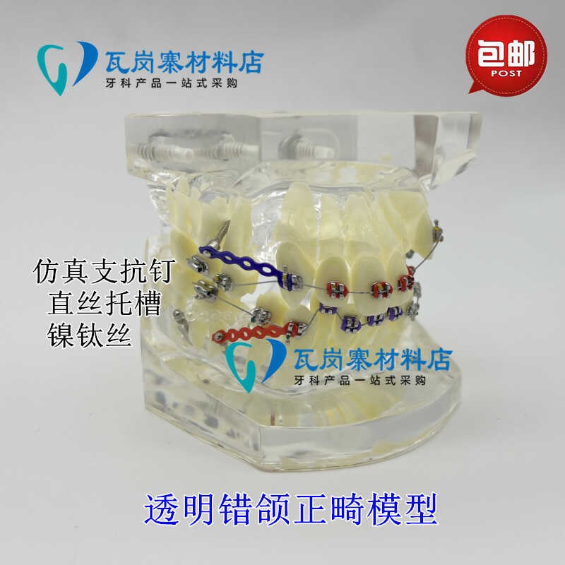 牙科正畸模型 透明错颌矫正展示模型 G结扎丝托槽正畸带支抗钉牙