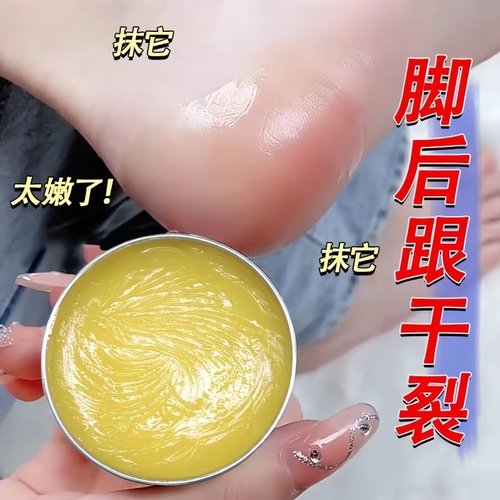 手足脚后跟干裂护手霜滋润补水