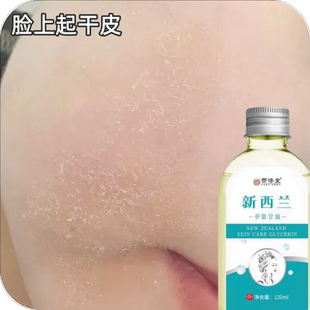 脸上起皮掉皮屑白屑脸发痒脸部皮肤干燥干皮粗糙起皮脸部爆皮皮肤