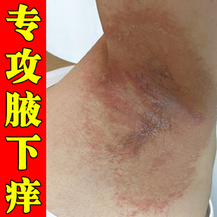 腋毛腋下红肿起小疙瘩出汗有出汗发臭神器胳肢窝淹
