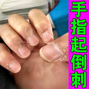 手指倒刺营养油指甲边缘起肉刺干皮脱皮修复神器去死皮裂纹防干裂