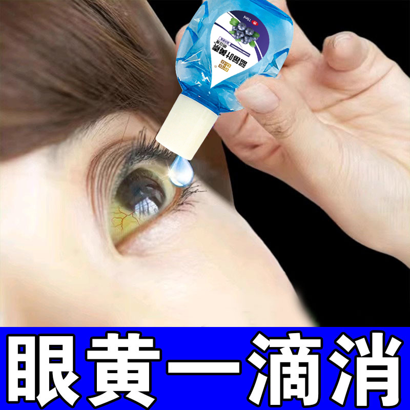【一滴去黄】眼白发黄清澈混浊眼球眼睛眼药水滴眼液去浑眼底黄斑