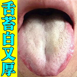 舌苔白厚脾胃健湿气口臭舌头发黄有齿裂痕祛去口干苦肝火旺盛调理