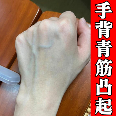 手背青筋凸起手面血管爆起外用软膏夏天天气热手上青筋腿上红血丝