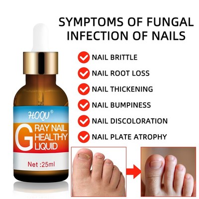 For Nail Fungal Treatment Feet Care Essence Extra Strong Nai