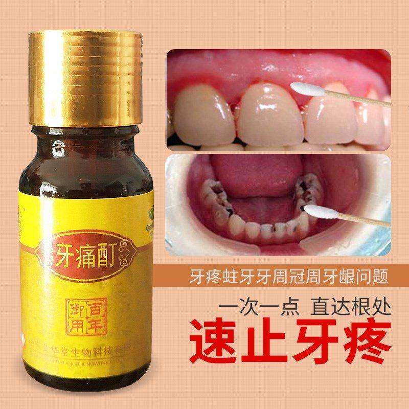 速发速效牙痛宁酊童牙疼牙痛牙龈肿疼上火牙神经痛蛀虫儿治成人