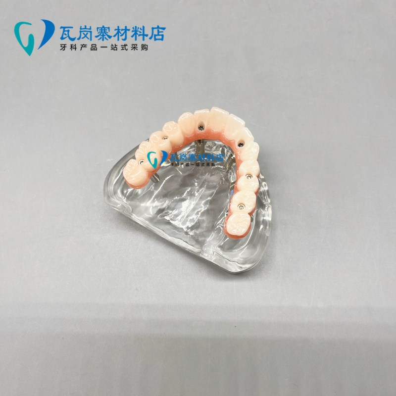 牙科口腔模型马龙连桥义齿修复种植牙齿仿L真演示模拟教学医患沟