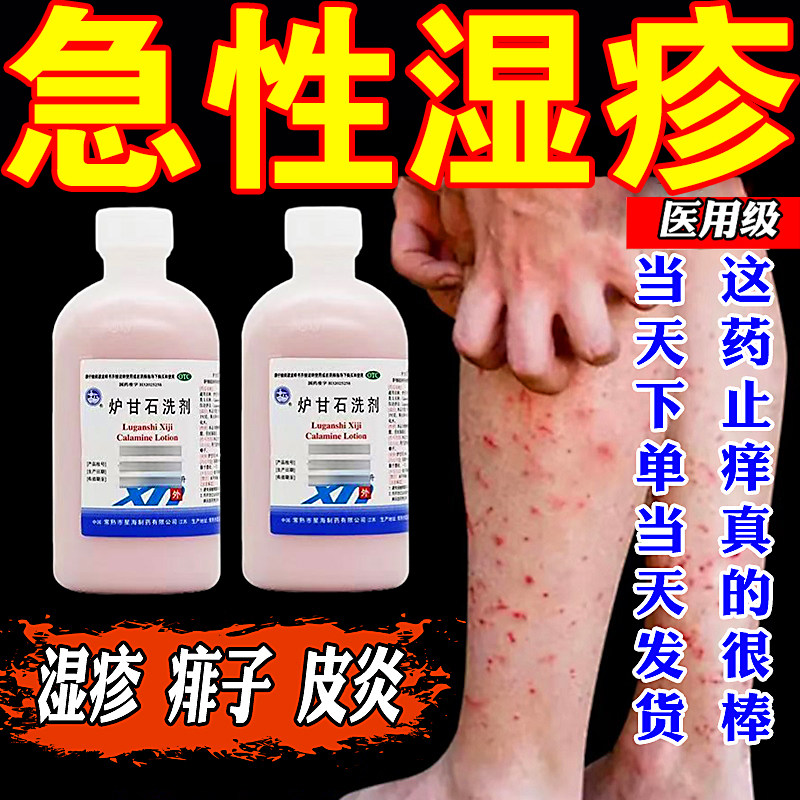 【信龙】炉甘石洗剂100ml*1瓶/盒
