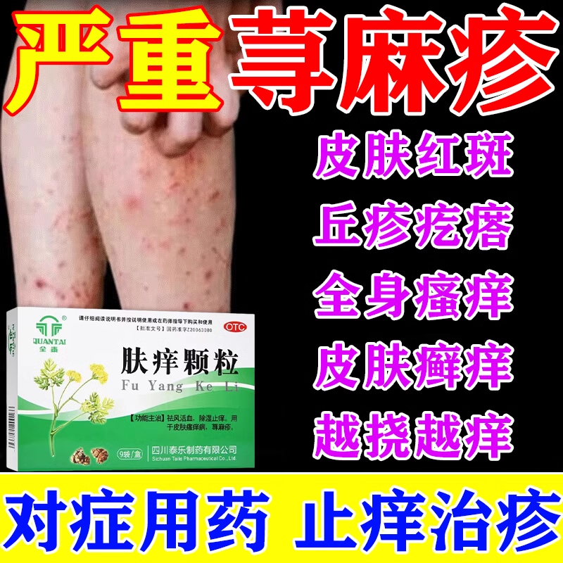 【摩美得】肤痒颗粒9g*9袋/盒