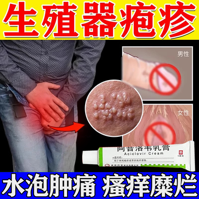 【太平】阿昔洛韦乳膏3%*10g*1支/盒