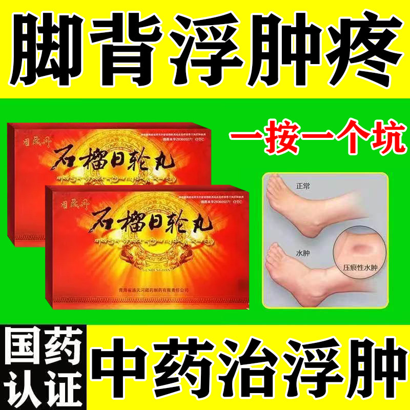 石榴日轮丸老人消脚肿水肿效消肿的药特水肿消肿药利尿排水肿药