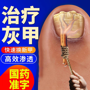专治疗去灰指甲专用药水膏脱甲除特正品旗舰店真菌感染效甲沟炎