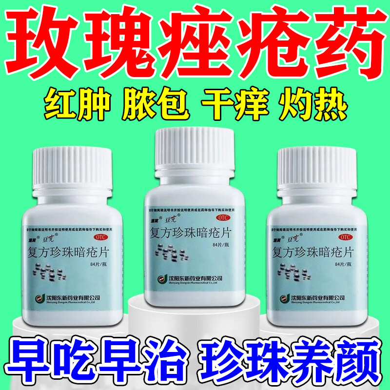 玫瑰痤疮口服中药脸上干燥起皮红血丝鼻子两边泛红复方珍珠暗疮片