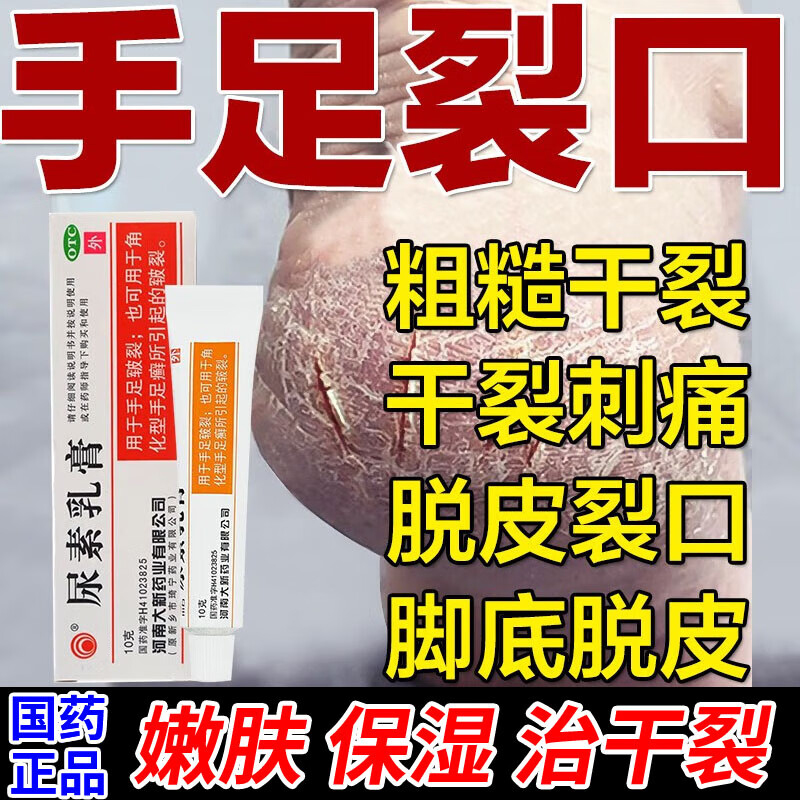 尿素软膏正品专治手足皲裂脚后跟干裂脱皮修复霜真菌感染硬皮药膏