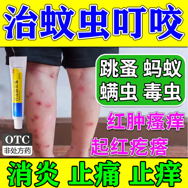 治蚊虫叮咬快速止痒消肿药膏儿童成人通用臭虫跳蚤蚊子抑菌去瘙痒
