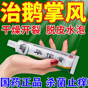 治疗鹅掌风专用药膏正品 手癣膏脱皮干裂真菌感染杀菌止痒华佗膏
