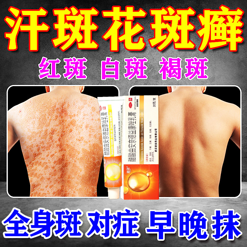 【嘉效】醋酸曲安奈德益康唑乳膏16.5mg150mg*20g*1支/盒