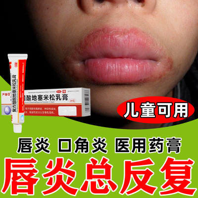 【太平洋】复方醋酸地塞米松乳膏20g*1瓶/盒